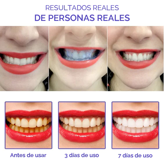 Pack blanqueador de dientes - 2 unidades