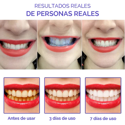 Pack blanqueador de dientes - 2 unidades